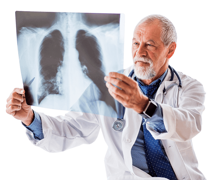 A male doctor holds up a chest X-ray