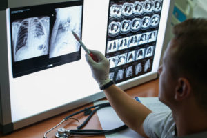 A doctor looks at a chest X-ray on a computer screen