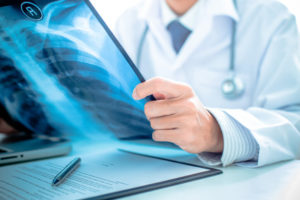 A doctor holds up an image of a chest X-ray