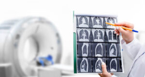 A doctor holds up a series of X-rays while a scanner is visible in the background