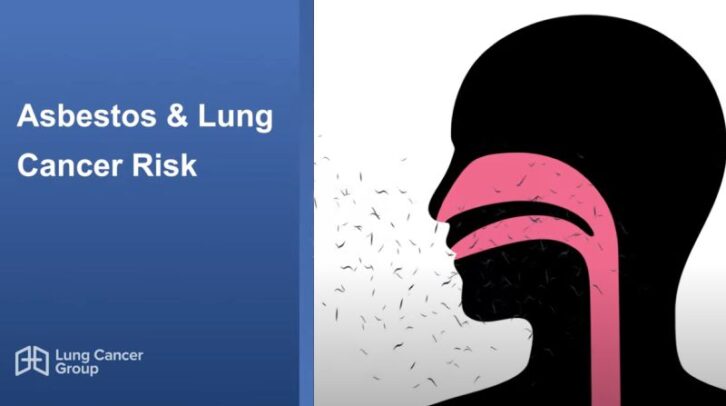 Risk of Lung Cancer from Asbestos Exposure Video Thumbnail