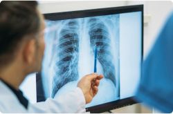 doctor examining a chest x-ray