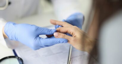 doctor examines fingers
