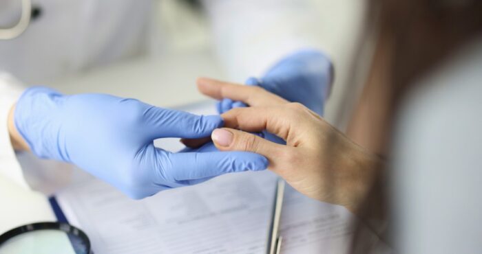 doctor examines fingers
