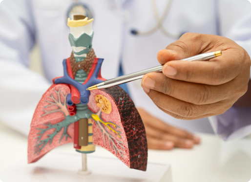 doctor pointing to a model lung